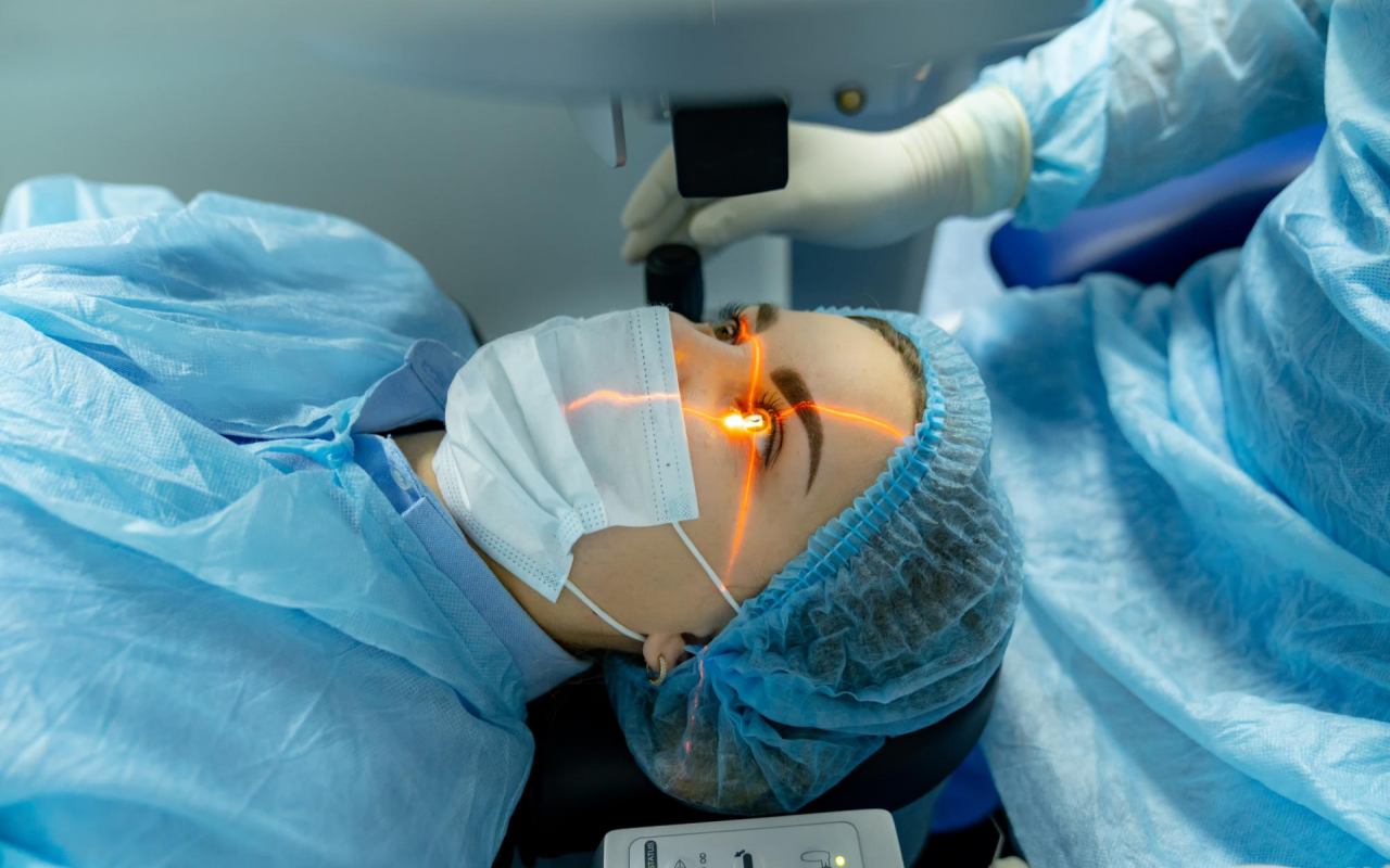 Procedimiento de cirugía refractiva con láser excimer